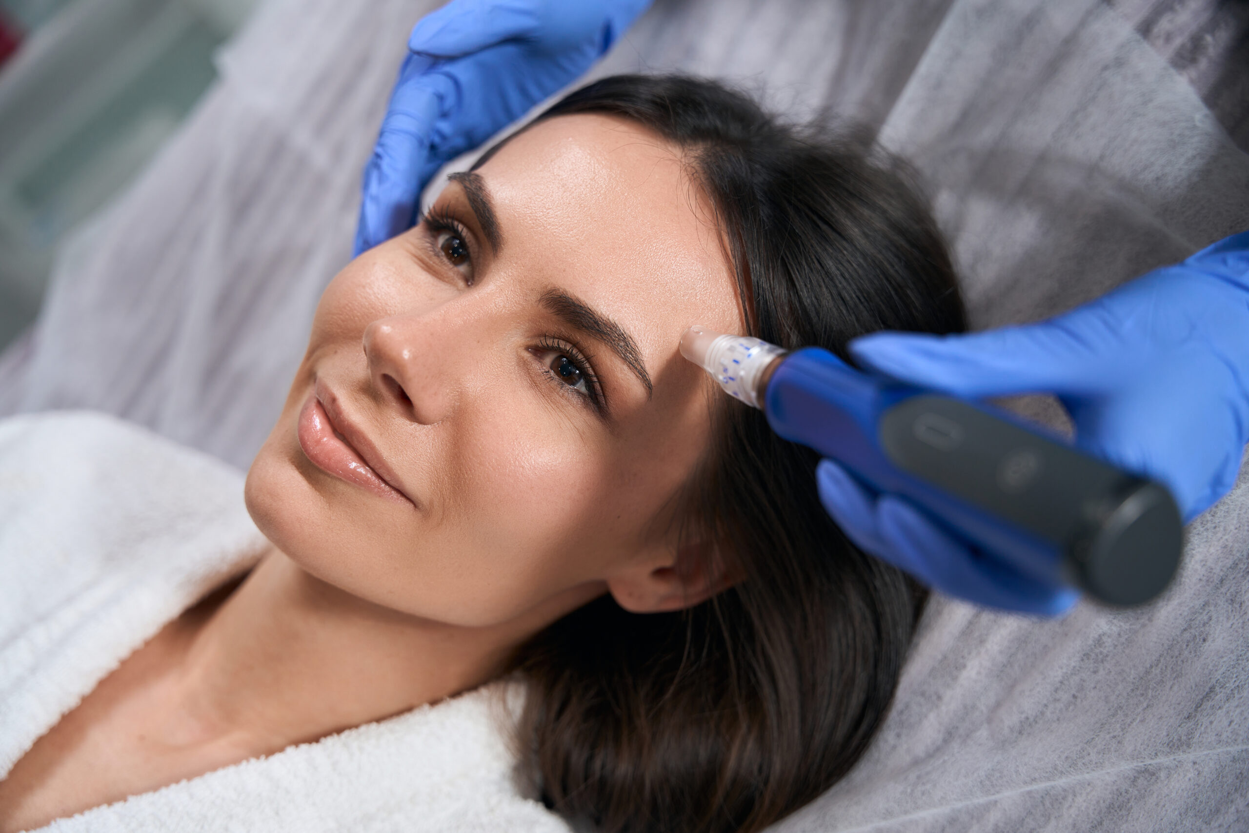 SkinPen Microneedling