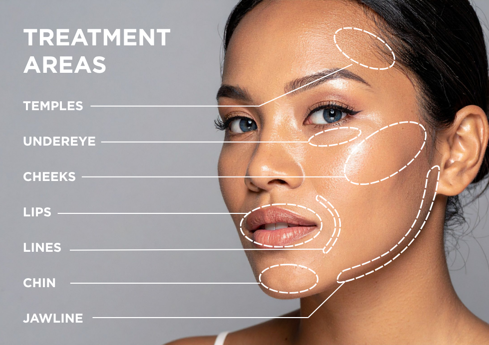 About Flexile Classic